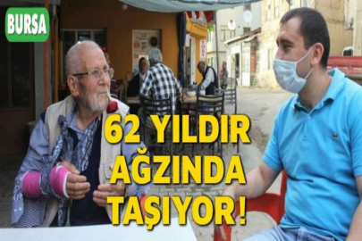 62 YILDIR AĞZINDA TAŞIYOR!