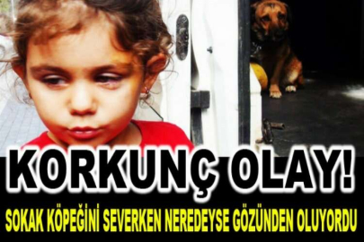 Antalya'da korkunç olay! Sokak köpeğini severken neredeyse gözünden oluyordu