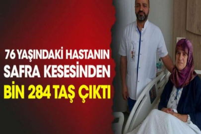 76 yaşındaki hastanın safra kesesinden bin 284 taş çıktı