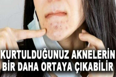 Kurtulduğunuz aknelerin bir daha ortaya çıkabilir