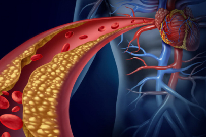 YÜKSEK KOLESTEROLÜN VÜCUDUMUZA BIRAKTIĞI HASAR!
